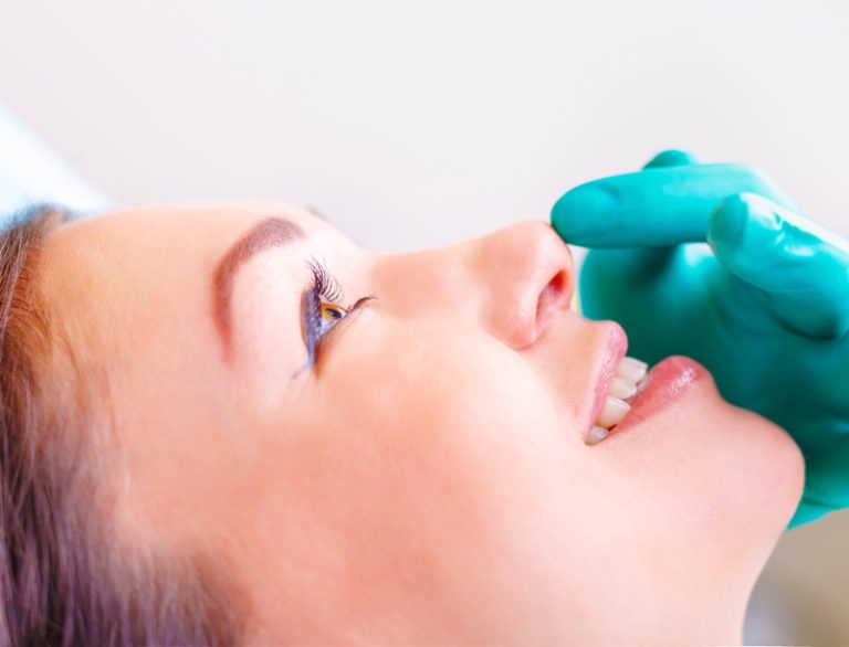 Rhinoplasty
